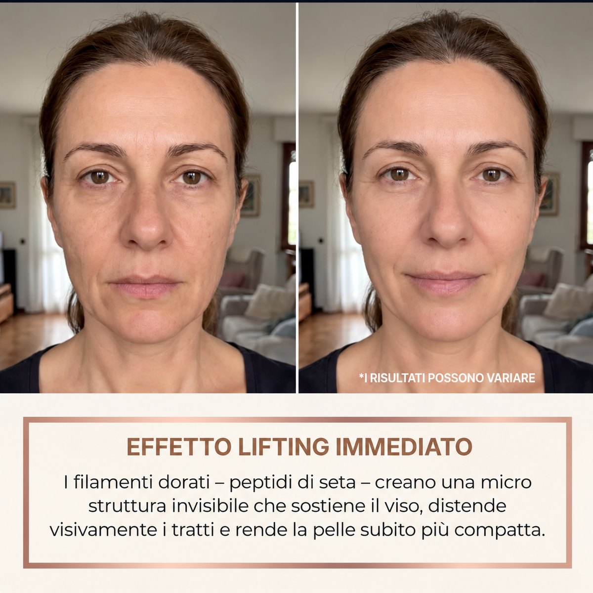 Liftea – Siero Coreano Effetto Lifting dalla Prima Applicazione