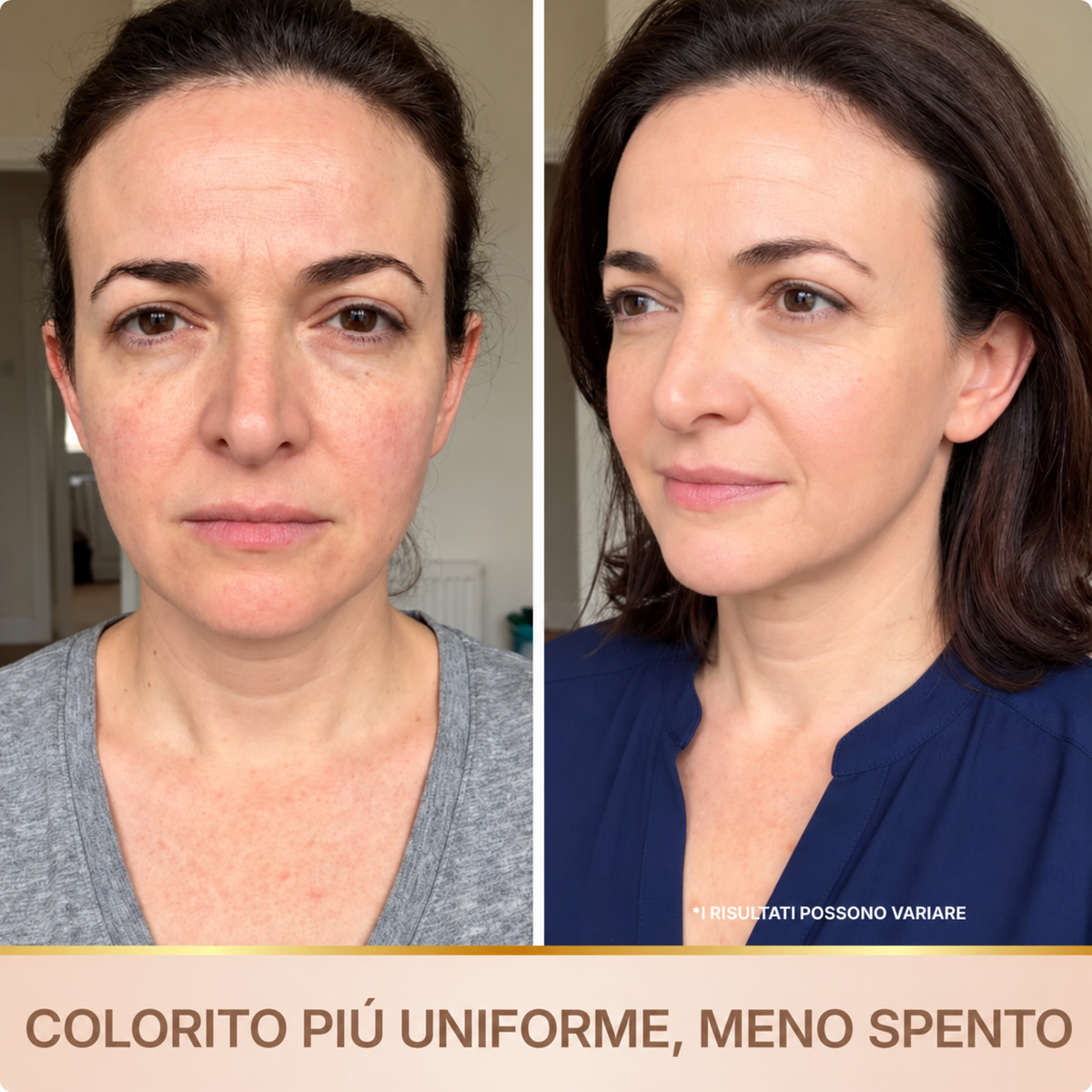 Liftea – Siero Coreano Effetto Lifting dalla Prima Applicazione