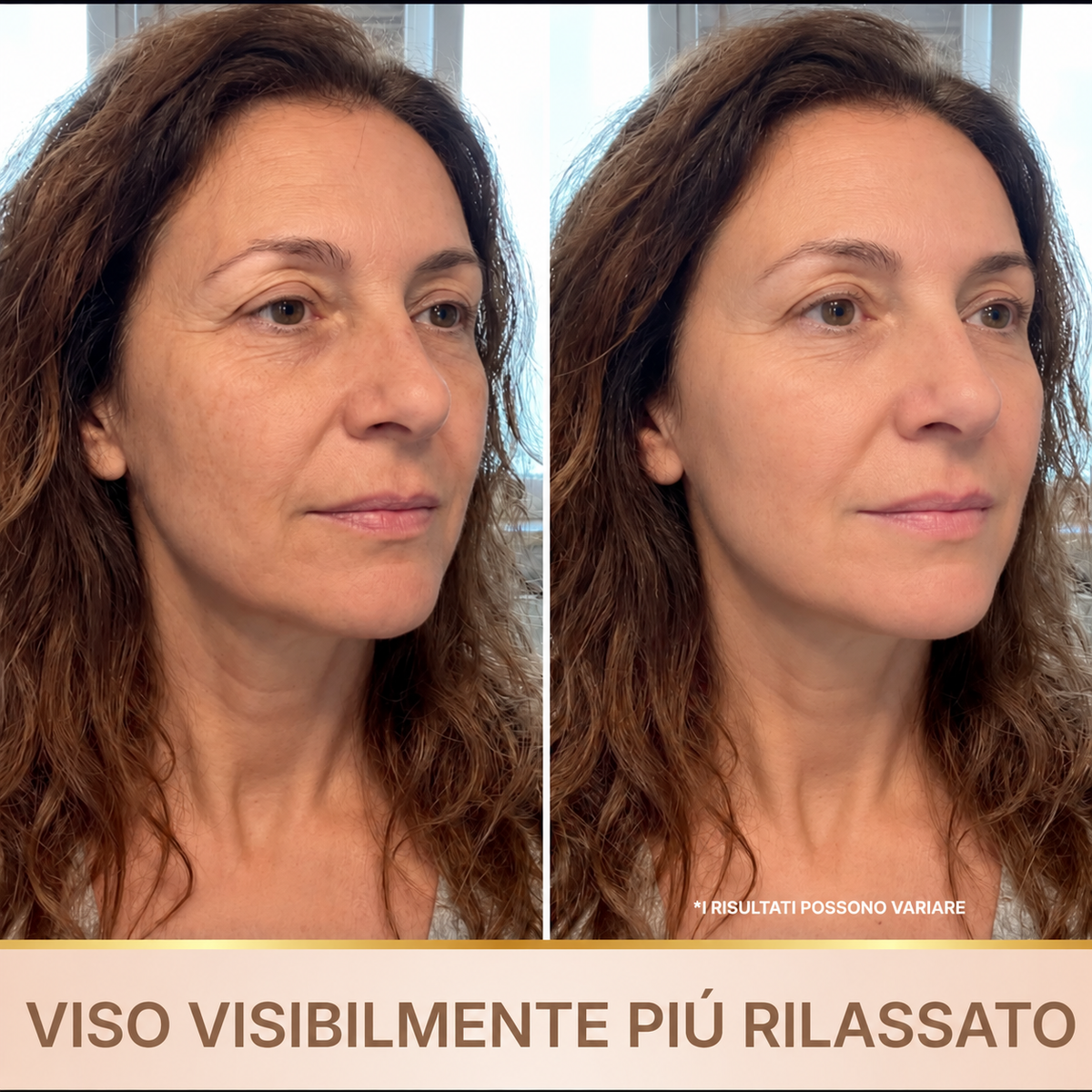 Liftea – Siero Coreano Effetto Lifting dalla Prima Applicazione